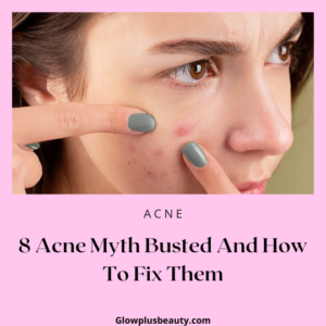 Acne Myths Busted