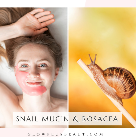 Is Snail Mucin Good For Rosacea.