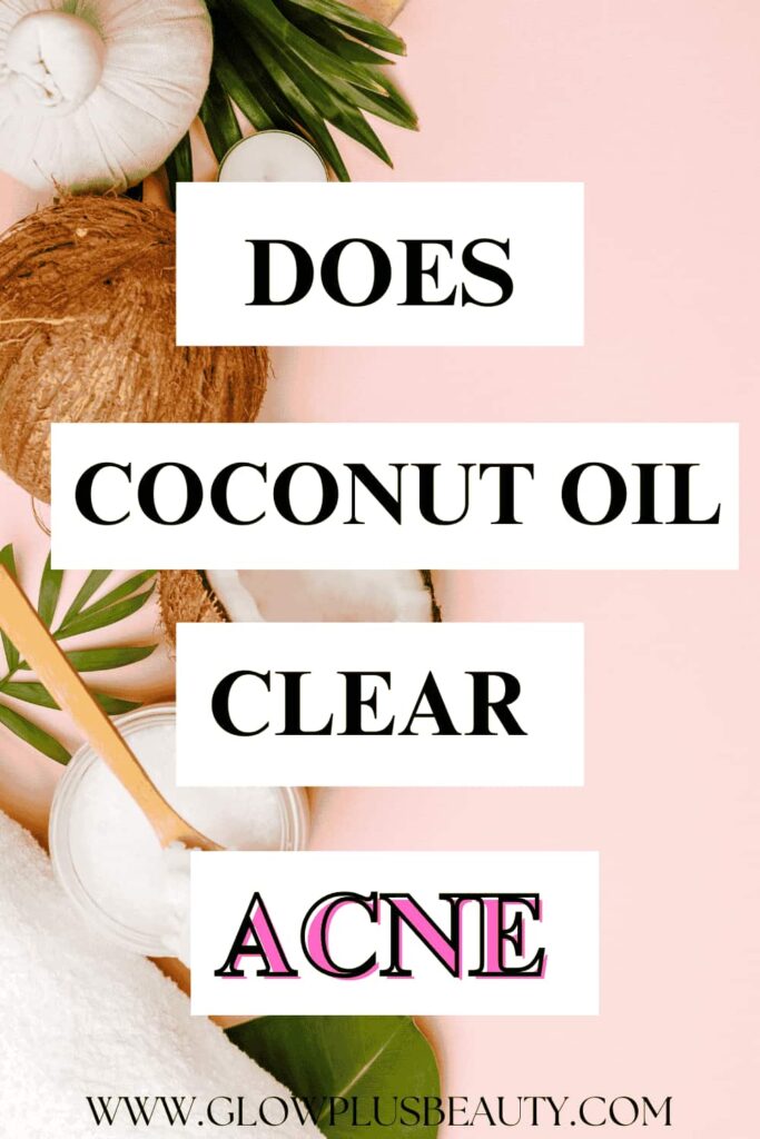 Does-coconut-oil-clear-acne