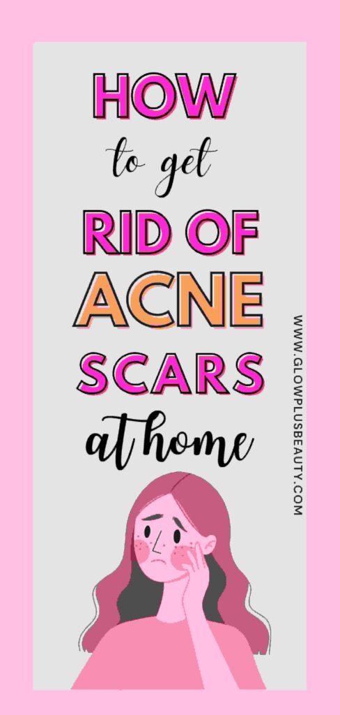 How to Get Rid of Acne Scars Naturally