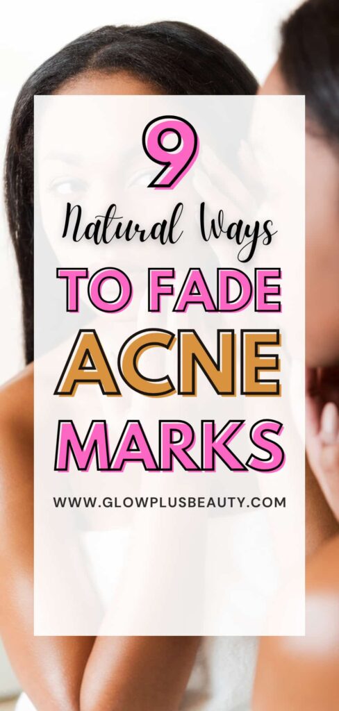 How to Get Rid of Acne Scars Naturally